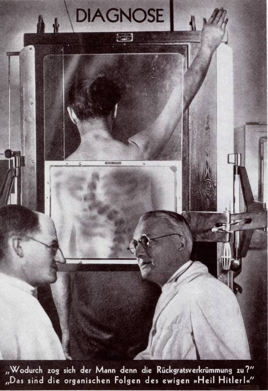 1933, John Heartfield, AJZ, «Diagnose».